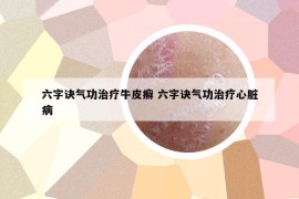 六字诀气功治疗牛皮癣 六字诀气功治疗心脏病