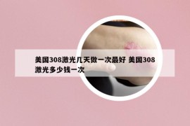 美国308激光几天做一次最好 美国308激光多少钱一次