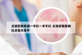 点滴型银屑病一半红一半不红 点滴状银屑病红点变大变平