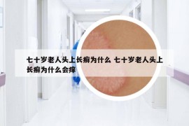 七十岁老人头上长癣为什么 七十岁老人头上长癣为什么会痒