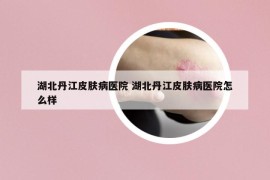 湖北丹江皮肤病医院 湖北丹江皮肤病医院怎么样