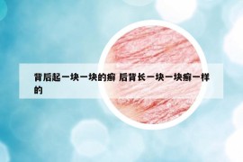 背后起一块一块的癣 后背长一块一块癣一样的