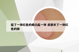 起了一块红色的癣凸起一块 皮肤长了一块红色的藓