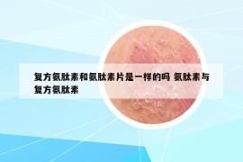 复方氨肽素和氨肽素片是一样的吗 氨肽素与复方氨肽素