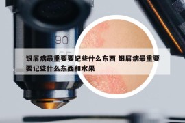 银屑病最重要要记些什么东西 银屑病最重要要记些什么东西和水果