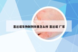 喜达诺生物制剂效果怎么样 喜达诺 厂家