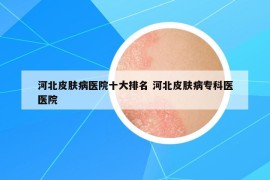 河北皮肤病医院十大排名 河北皮肤病专科医医院