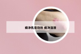 癣净乳膏功效 癣净溶液