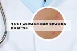 什么叫儿童急性点滴型银屑病 急性点滴状银屑病治疗方法