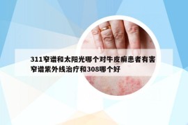 311窄谱和太阳光哪个对牛皮癣患者有害 窄谱紫外线治疗和308哪个好