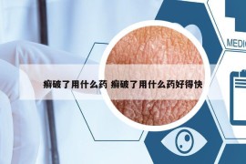 癣破了用什么药 癣破了用什么药好得快