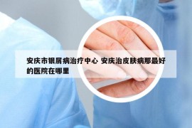 安庆市银屑病治疗中心 安庆治皮肤病那最好的医院在哪里