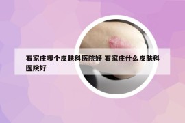 石家庄哪个皮肤科医院好 石家庄什么皮肤科医院好