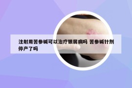 注射用苦参碱可以治疗银屑病吗 苦参碱针剂停产了吗