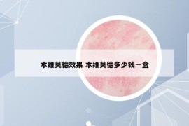 本维莫德效果 本维莫德多少钱一盒