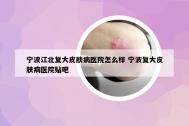 宁波江北复大皮肤病医院怎么样 宁波复大皮肤病医院贴吧