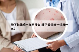 腋下长像癣一样用什么 腋下长像癣一样用什么?