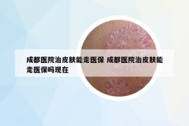 成都医院治皮肤能走医保 成都医院治皮肤能走医保吗现在