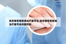 南京哪家银屑病治疗最专业 南京哪家银屑病治疗最专业的医院好