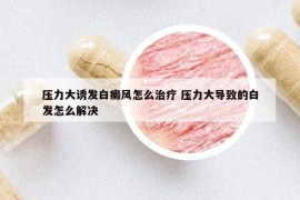 压力大诱发白癜风怎么治疗 压力大导致的白发怎么解决