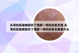 头发的后面根部长了像藓一样的白色东西 头发的后面根部长了像藓一样的白色东西是什么