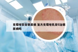 克霉唑软膏银屑病 复方克霉唑乳膏ll治银屑病吗