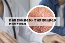 百癣夏塔热胶囊吃多久 百癣夏塔热胶囊吃多久痘痘才能根治