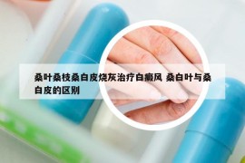 桑叶桑枝桑白皮烧灰治疗白癜风 桑白叶与桑白皮的区别