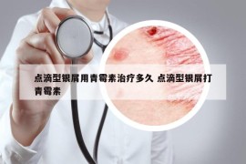 点滴型银屑用青霉素治疗多久 点滴型银屑打青霉素