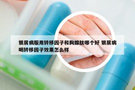 银屑病服用转移因子和胸腺肽哪个好 银屑病喝转移因子效果怎么样