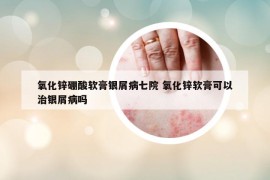 氧化锌硼酸软膏银屑病七院 氧化锌软膏可以治银屑病吗