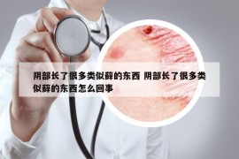 阴部长了很多类似藓的东西 阴部长了很多类似藓的东西怎么回事