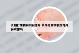 长期打生物制剂副作用 长期打生物制剂对身体有害吗