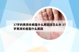 17岁的男孩长癣是什么原因该怎么办 17岁男孩长痘是什么原因