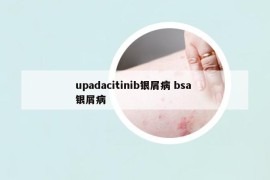 upadacitinib银屑病 bsa 银屑病