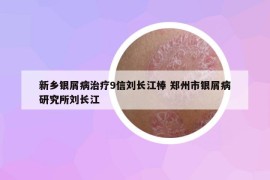 新乡银屑病治疗9信刘长江棒 郑州市银屑病研究所刘长江