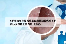 6岁女宝每年夏天脸上白斑是缺锌吗吗 6岁的小女孩脸上有白斑,怎么办