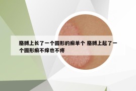 胳膊上长了一个圆形的癣单个 胳膊上起了一个圆形癣不痒也不疼