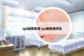 IgG副银屑病 iga银屑病评估