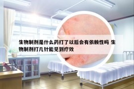 生物制剂是什么药打了以后会有依赖性吗 生物制剂打几针能见到疗效