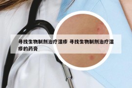 寻找生物制剂治疗湿疹 寻找生物制剂治疗湿疹的药膏