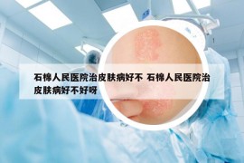 石棉人民医院治皮肤病好不 石棉人民医院治皮肤病好不好呀