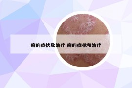 癣的症状及治疗 癣的症状和治疗