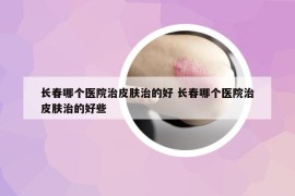 长春哪个医院治皮肤治的好 长春哪个医院治皮肤治的好些