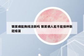 银屑病能胸线法新吗 银屑病人能不能接种新冠疫苗