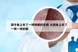 孩子身上长了一块块癣的东西 小孩身上长了一块一块的癣