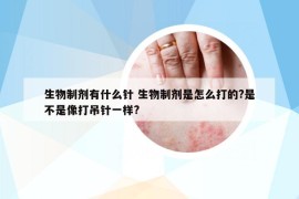 生物制剂有什么针 生物制剂是怎么打的?是不是像打吊针一样?