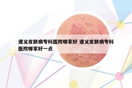 遵义皮肤病专科医院哪家好 遵义皮肤病专科医院哪家好一点