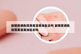 副银屑病色斑用美容美体能去吗 副银屑病色斑用美容美体能去吗