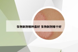 生物制剂哪种最好 生物制剂哪个好